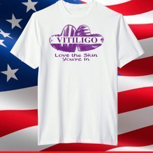 Vitiligo love the skin you’re in shirt