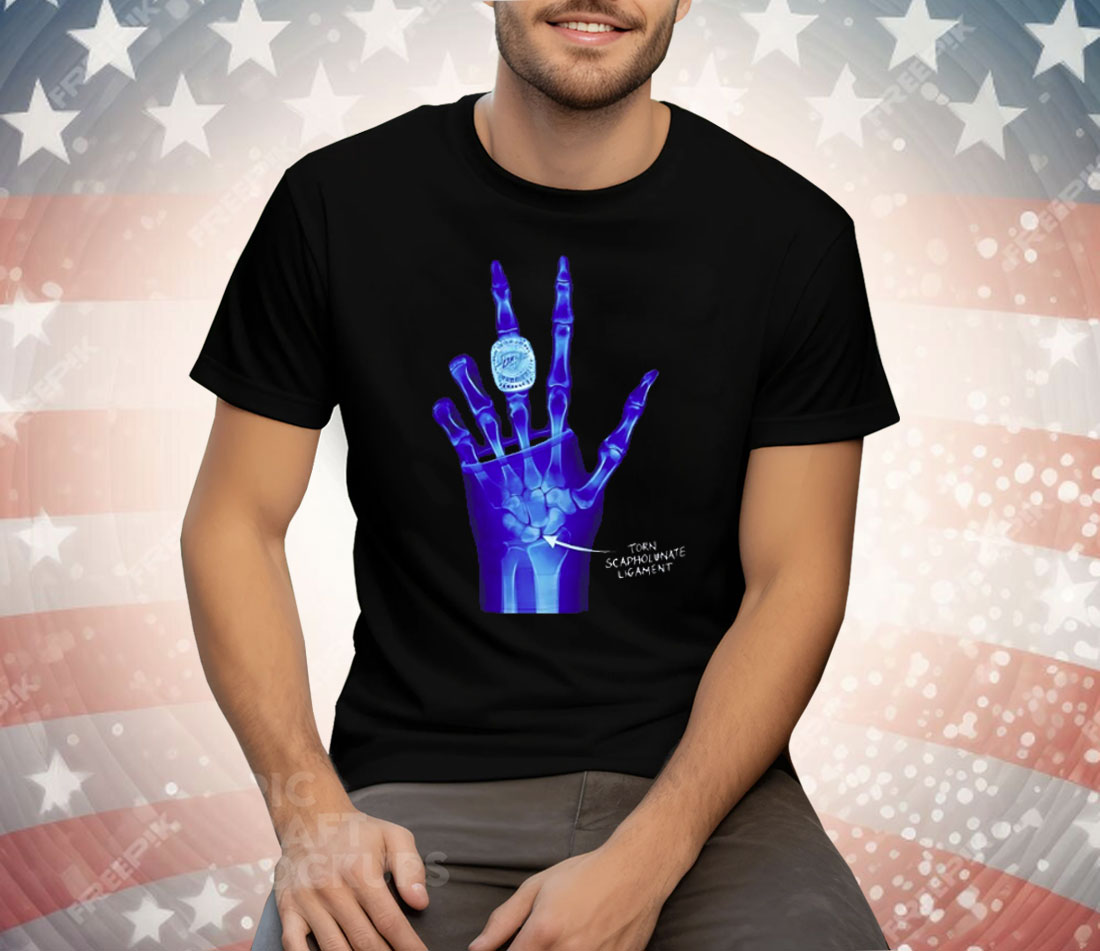 Kobe Bryant LA Lakers X-Ray Broken Torn Scapholunate Ligament Tee Shirt