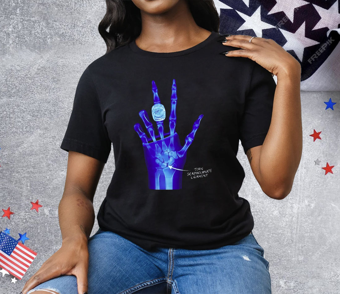 Kobe Bryant LA Lakers X-Ray Broken Torn Scapholunate Ligament Tee Shirt